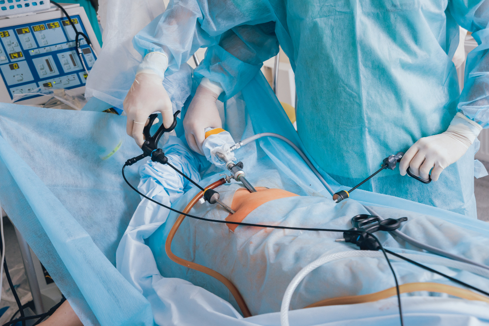 Laparoscopy